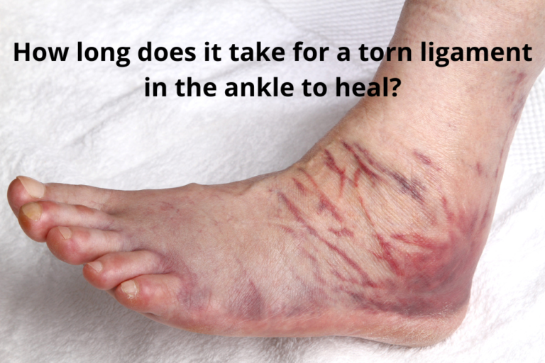 How Long Do Ruptured Ligaments Take To Heal