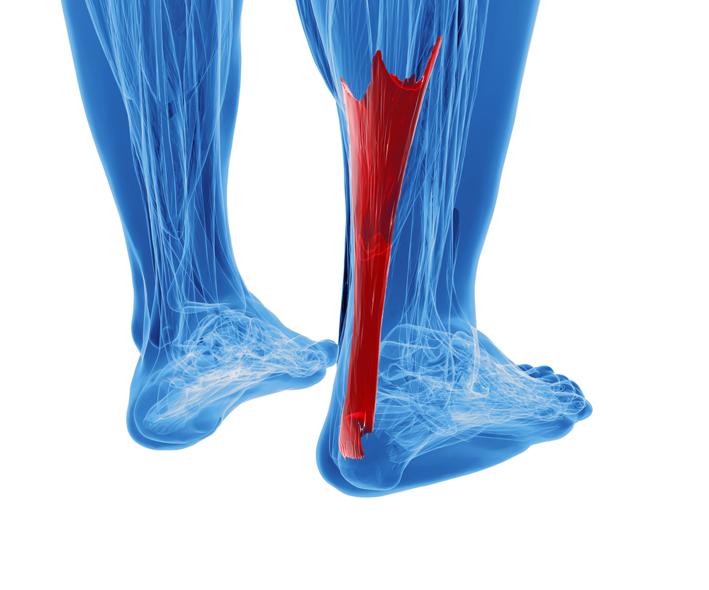 how long will it take for achilles tendonitis to heal